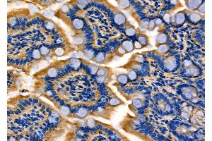 ABIN6260403 and ABIN6277987 at 1/100 staining Mouse colorectal tissue by IHC-P. (Calretinin anticorps  (Internal Region))