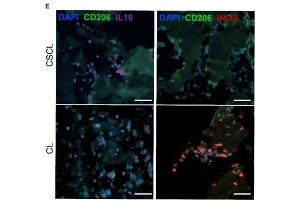 Characterization of infiltrating cells at day 1 post implant. (IL-10 anticorps  (AA 101-178))