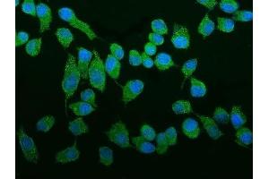 IF analysis of ROCK2 using anti-ROCK2 antibody (ABIN7602236).