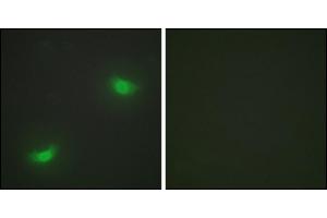 Immunofluorescence analysis of HepG2 cells, using DUSP16 antibody.