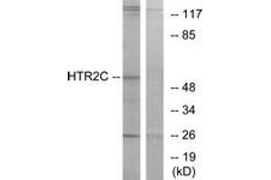 Western Blotting (WB) image for anti-5-Hydroxytryptamine (serotonin) Receptor 2C (HTR2C) (AA 395-444) antibody (ABIN2890745) (HTR2C anticorps  (AA 395-444))