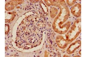 Immunohistochemistry of paraffin-embedded human kidney tissue using ABIN7151839 at dilution of 1:100 (EPH Receptor A4 anticorps  (AA 345-545))