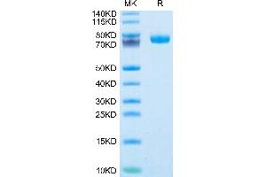 Human FcRH6 /FCRL6 on Tris-Bis PAGE under reduced condition.