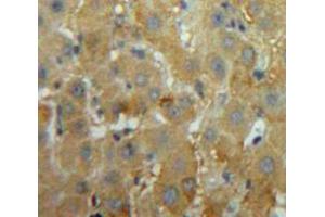 Used in DAB staining on fromalin fixed paraffin-embedded Liver tissue (MEPE anticorps  (AA 212-445))
