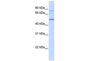 anti-Amyotrophic Lateral Sclerosis 2 (Juvenile) Chromosome Region, Candidate 12 (ALS2CR12) (AA 36-85) antibody
