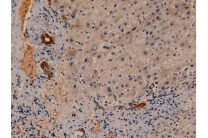 Detection of CK19 in Human Liver Tissue using Monoclonal Antibody to Cytokeratin 19 (CK19) (Cytokeratin 19 anticorps  (AA 245-391))