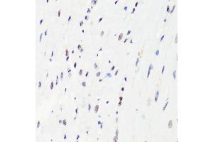 Immunohistochemistry of paraffin-embedded rat heart using MonoMethyl-Histone H3-R8 antibody (ABIN3017482, ABIN3017483, ABIN3017484 and ABIN6220107) at dilution of 1:100 (40x lens).