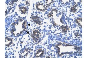RPS16 antibody was used for immunohistochemistry at a concentration of 4-8 ug/ml to stain Alveolar cells (arrows) in Human Lung.