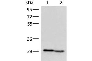 Western blot analysis of Human fetal intestines tissue and Human fetal liver tissue lysates using KLRB1 Polyclonal Antibody at dilution of 1:800 (CD161 anticorps)