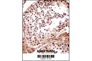 TNKS Antibody immunohistochemistry analysis in formalin fixed and paraffin embedded human testis tissue followed by peroxidase conjugation of the secondary antibody and DAB staining.