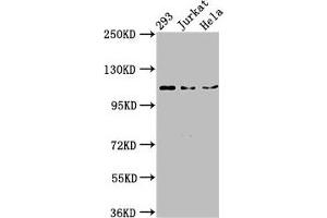 Western Blot Positive WB detected in: 293 whole cell lysate, Jurkat whole cell lysate, Hela whole cell lysate All lanes: NEDD4L antibody at 3 μg/mL Secondary Goat polyclonal to rabbit IgG at 1/50000 dilution Predicted band size: 112, 105, 101, 99, 111, 110, 97 kDa Observed band size: 112 kDa