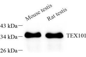 Western blot analysis of TEX101 (ABIN7075861) at dilution of 1: 1000 (TEX101 anticorps)