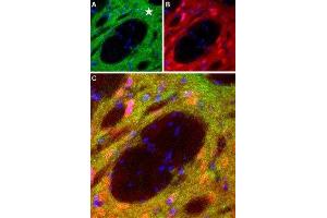 Expression of DRD1 in rat striatum - Immunohistochemical staining of perfusion-fixed frozen brain sections with Anti-D1 Dopamine Receptor Antibody (ABIN7043105, ABIN7044227 and ABIN7044228), (1:100), (green).