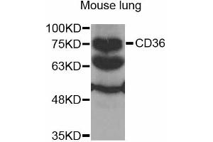 Western blot analysis of extracts of mouse lung, using CD36 antibody (ABIN2561720) at 1:1000 dilution. (CD36 anticorps)