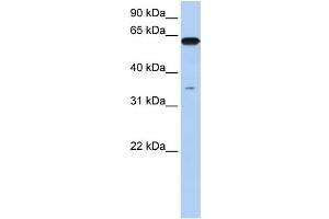 WB Suggested Anti-KPNA6 Antibody Titration: 0. (KPNA6 anticorps  (N-Term))