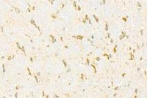 Immunohistochemistry analysis of paraffin-embedded mouse cerebellum using ADAMTS4 (ABIN7072947) at dilution of 1: 500 (ADAMTS4 anticorps)