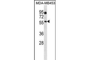 B4GALNT1 Antibody (Center) (ABIN1538263 and ABIN2849848) western blot analysis in MDA-M cell line lysates (35 μg/lane). (B4GALNT1 anticorps  (AA 296-323))