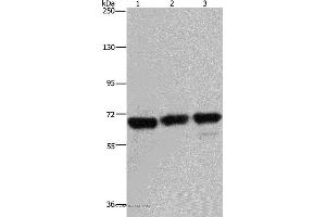 Western blot analysis of 293T, Jurkat and Hela cell, using PCK2 Polyclonal Antibody at dilution of 1:750 (PEPCK anticorps)