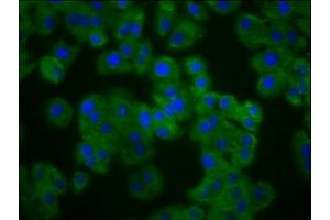 Immunofluorescence staining of HepG2 cells with ABIN7162591 at 1:133, counter-stained with DAPI.