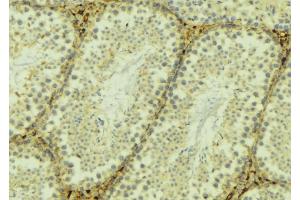ABIN6268946 at 1/100 staining Mouse testis tissue by IHC-P. (TXNRD2 anticorps  (C-Term))