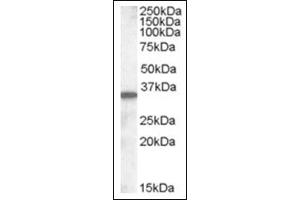 Image no. 1 for anti-Solute Carrier Family 10 (Sodium/bile Acid Cotransporter Family), Member 2 (SLC10A2) (C-Term) antibody (ABIN375244) (SLC10A2 anticorps  (C-Term))