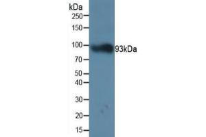Rabbit Detection antibody from the kit in WB with Positive Control: Sample Human serum.