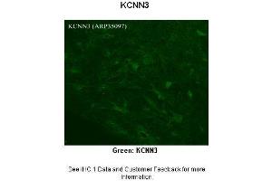 Sample Type :  Rhesus macaque spinal cord  Primary Antibody Dilution :  1:300  Secondary Antibody :  Donkey anti Rabbit 488  Secondary Antibody Dilution :  1:500  Color/Signal Descriptions :  Green: KCNN3  Gene Name :  KCNN3  Submitted by :  Timur Mavlyutov, Ph. (KCNN3 anticorps  (C-Term))