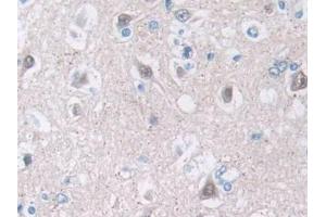 Detection of PFN2 in Human Cerebrum Tissue using Polyclonal Antibody to Profilin 2 (PFN2)