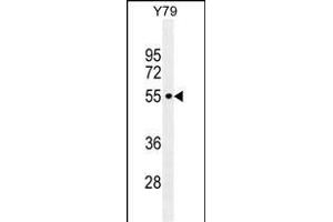 CCDC97 Antibody (C-term) (ABIN655301 and ABIN2844887) western blot analysis in Y79 cell line lysates (35 μg/lane). (CCDC97 anticorps  (C-Term))