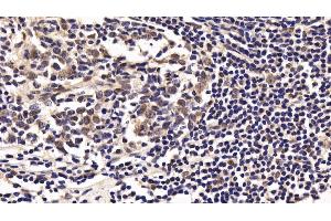 Detection of IL10Ra in Human Appendix Tissue using Polyclonal Antibody to Interleukin 10 Receptor Alpha (IL10Ra) (IL-10RA anticorps  (AA 132-235))