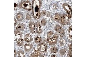 Immunohistochemical staining of human breast with MUCL1 polyclonal antibody  shows moderate cytoplasmic and extracellular positivity in glandular cells at 1:20-1:50 dilution. (SBEM anticorps)