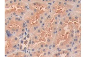 Detection of OIT3 in Human Kidney Tissue using Polyclonal Antibody to Oncoprotein Induced Transcript 3 (OIT3)