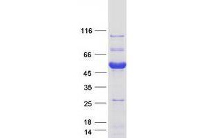 Validation with Western Blot