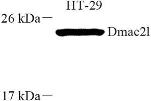 Western blot analysis of Dmac2l (ABIN7073751) at dilution of 1: 250 (Distal Membrane Arm Assembly Complex 2 L Homeolog (DMAC2.L) anticorps)