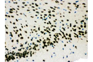 Anti- SMN1/2 Picoband antibody,IHC(P) IHC(P): Mouse Brain Tissue