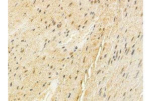 AR Mouse Monoclonal Antibody at 1/100 staining mouse heart tissue by IHC-P.