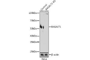 Western blot analysis of extracts from normal (control) and B4G knockout (KO) HeLa cells, using B4G antibody (ABIN6133203, ABIN6137403, ABIN6137404 and ABIN6224642) at 1:3000 dilution.