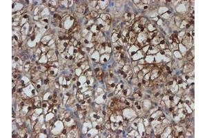 Image no. 10 for anti-Spermidine/Spermine N1-Acetyltransferase 2 (SAT2) antibody (ABIN1500807)