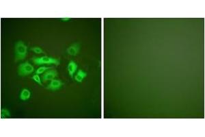 Immunofluorescence analysis of A549 cells, using Keratin 10 Antibody. (Keratin 10 anticorps  (AA 136-185))
