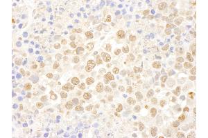 Immunohistochemistry (IHC) image for anti-DEAD (Asp-Glu-Ala-Asp) Box Polypeptide 27 (DDX27) (AA 700-750) antibody (ABIN7448950)
