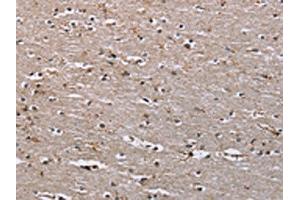 The image on the left is immunohistochemistry of paraffin-embedded Human brain tissue using ABIN7191114(IQCJ Antibody) at dilution 1/30, on the right is treated with synthetic peptide. (IQCJ anticorps)