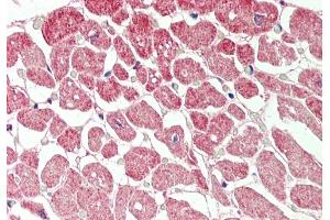 Rabbit Anti-CRLS1 antibody  Formalin Fixed Paraffin Embedded Tissue: Human Heart Primary antibody Concentration: 1:100 Secondary Antibody: Donkey anti-Rabbit-Cy3 Secondary Antibody Concentration: 1:200 Magnification: 20x Exposure Time: 0.