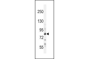 Z Antibody (N-term) (ABIN654759 and ABIN2844443) western blot analysis in WiDr cell line lysates (35 μg/lane). (ZNF180 anticorps  (N-Term))