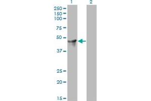 Western Blot analysis of CYTH2 expression in transfected 293T cell line by CYTH2 monoclonal antibody (M02), clone 6H5. (Cytohesin 2 anticorps  (AA 314-398))