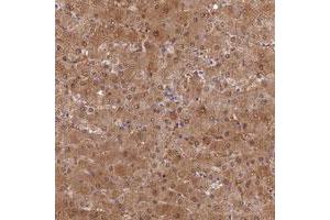 Immunohistochemical staining of human liver with SLC25A41 polyclonal antibody  shows moderate cytoplasmic and nuclear positivity in hepatocytes at 1:50-1:200 dilution. (SLC25A41 anticorps)