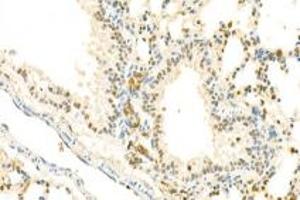 Immunohistochemistry analysis of paraffin-embedded mouse lung using,IOP2 (ABIN7074883) at dilution of 1: 2000 (NARF anticorps)