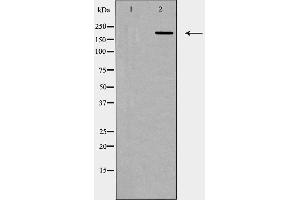 Western blot analysis of 53BP1 expression in HUVEC cells.