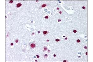 Immunohistochemistry (IHC) image for anti-Scaffold Attachment Factor B2 (SAFB2) (AA 345-357) antibody (ABIN302304) (SAFB2 anticorps  (AA 345-357))