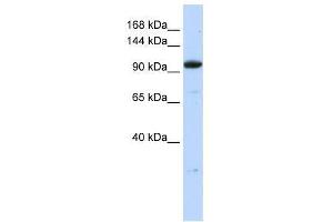 ZNF228 antibody used at 2. (ZFP112 anticorps  (N-Term))
