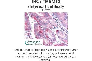 Image no. 2 for anti-Transmembrane Protein 33 (TMEM33) (Internal Region) antibody (ABIN1740155) (TMEM33 anticorps  (Internal Region))